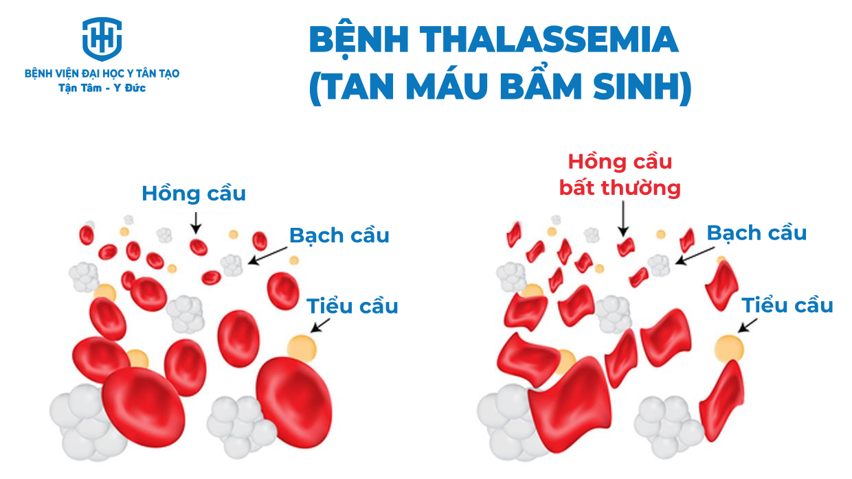 Image: PHƯỜNG 6: NGÀY THALASSEMIA THẾ GIỚI (8/5/2024)